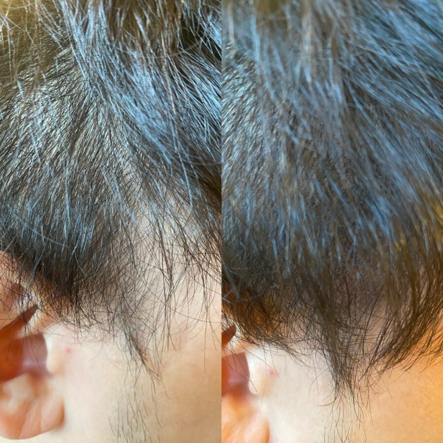 分け目BeforeAfter